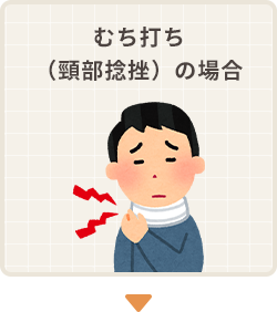 むち打ち（頸部捻挫）の場合